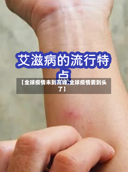 【全球疫情未到高峰,全球疫情要到头了】-第2张图片