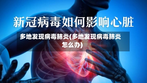 多地发现病毒肺炎(多地发现病毒肺炎怎么办)-第2张图片