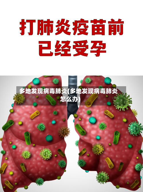 多地发现病毒肺炎(多地发现病毒肺炎怎么办)-第3张图片