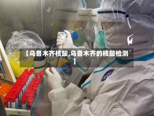 【乌鲁木齐核酸,乌鲁木齐的核酸检测】